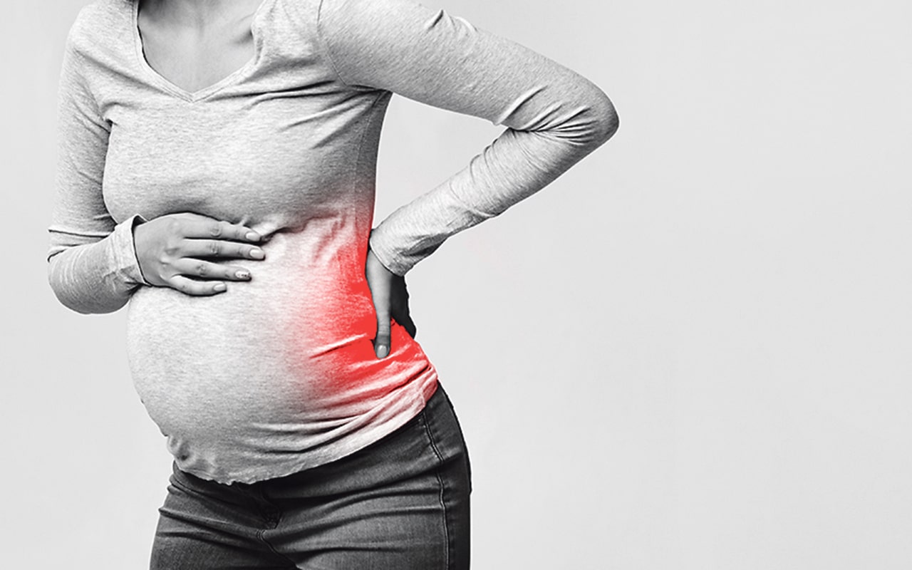 Managing sciatica during pregnancy