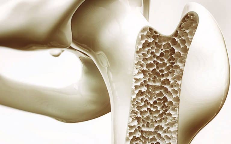 Osteoporosis prevention…make no bones about it